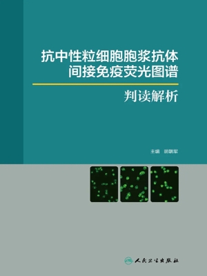 抗中性粒细胞胞浆抗体