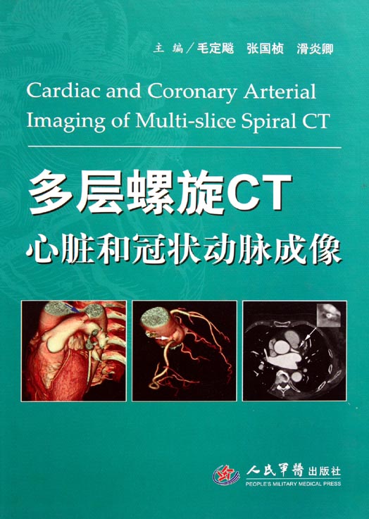 多层螺旋CT心脏和冠状