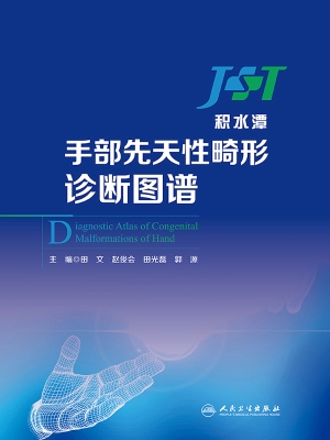 手部先天性畸形诊断图