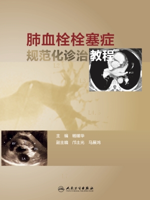 肺血栓栓塞症规范化诊