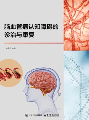 脑血管病认知障碍的诊