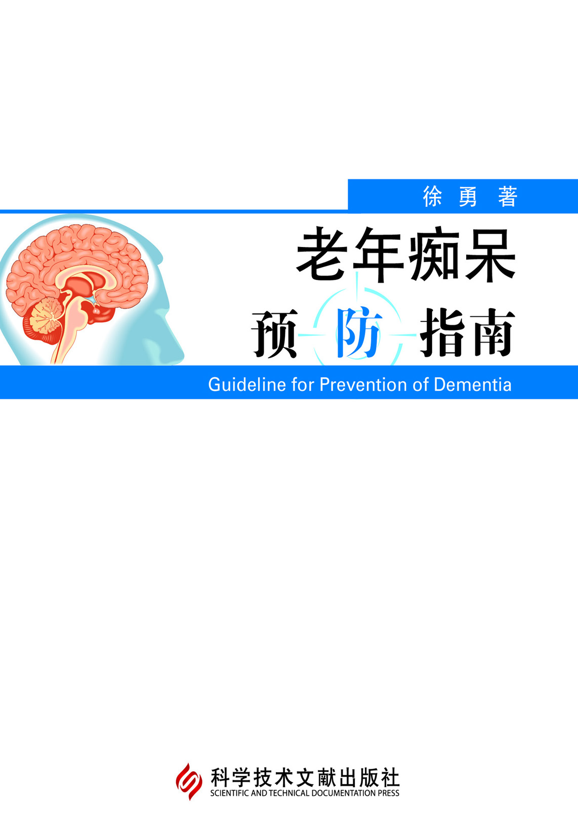 老年痴呆预防指南