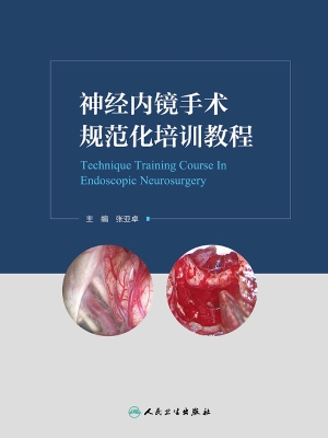 神经内镜手术规范化培
