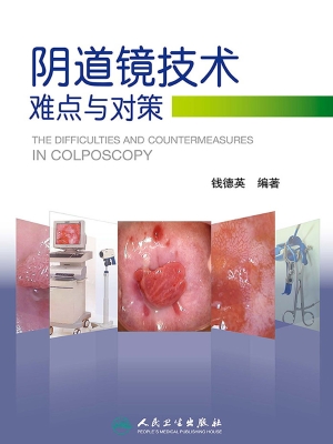 阴道镜技术难点与对策