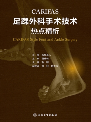 CARIFAS足踝外科手术
