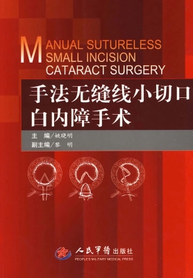 手法无缝线小切口白内