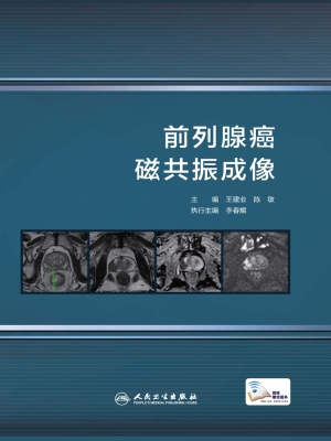 前列腺癌磁共振成像