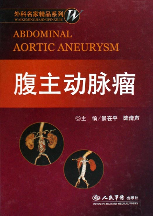 腹主动脉瘤