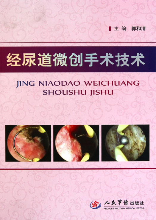 经尿道微创手术技术