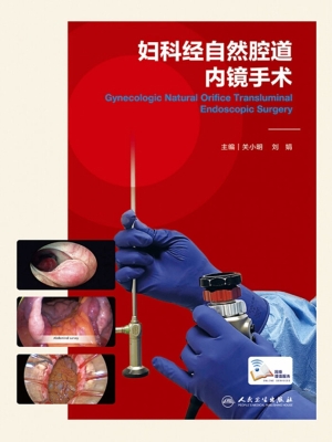 妇科经自然腔道内镜手