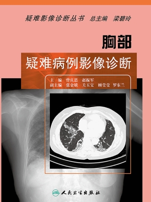 胸部疑难病例影像诊断