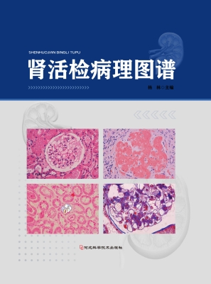 肾活检病理图谱