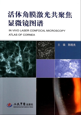 活体角膜激光共聚焦显