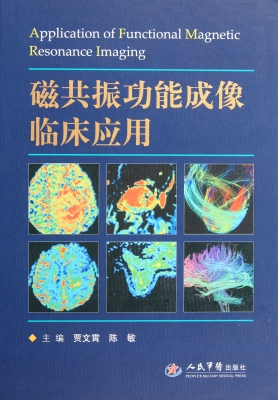 磁共振功能成像临床应