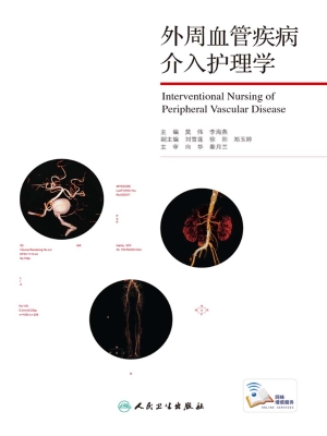外周血管疾病介入护理
