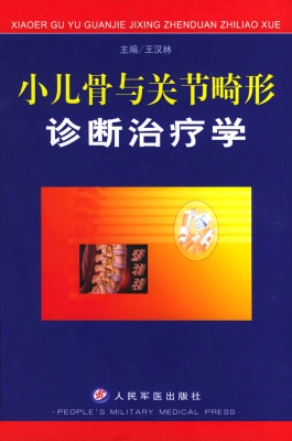 小儿骨与关节畸形诊断