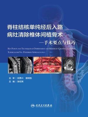 脊柱结核单纯经后入路