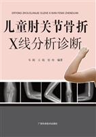 儿童肘关节骨折X线分