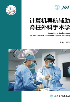 计算机导航辅助脊柱外