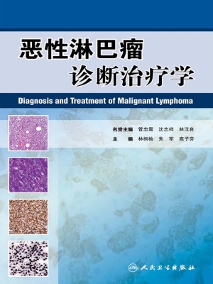 恶性淋巴瘤诊断治疗学