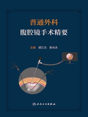 普通外科腹腔镜手术精