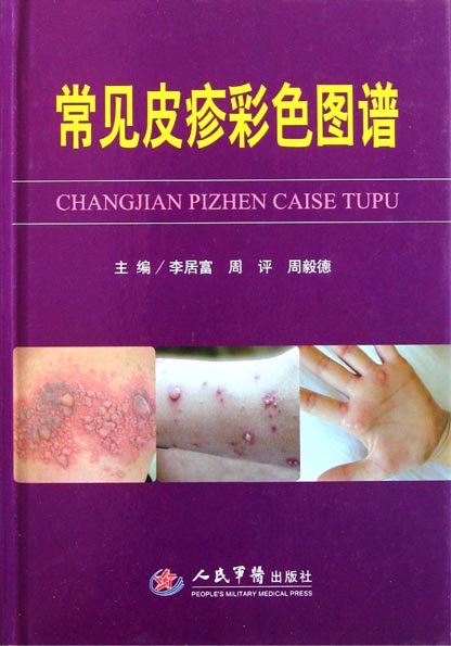 常见皮疹彩色图谱