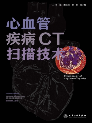 心血管疾病CT扫描技术