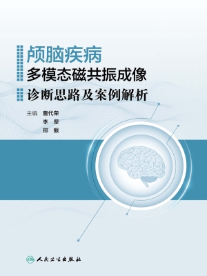 颅脑疾病多模态磁共振