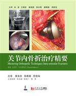 关节内骨折治疗精要
