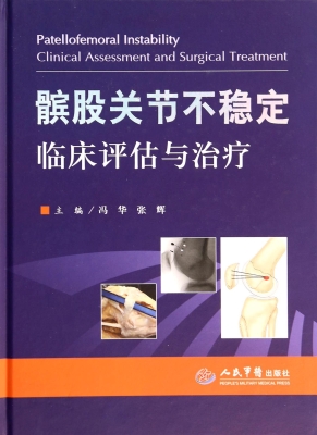 髌股关节不稳定临床评