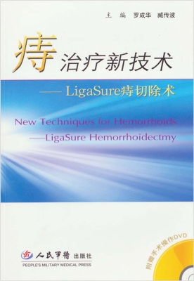 痔治疗新技术——Liga