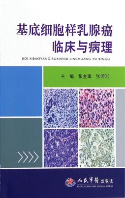 基底细胞样乳腺癌临床