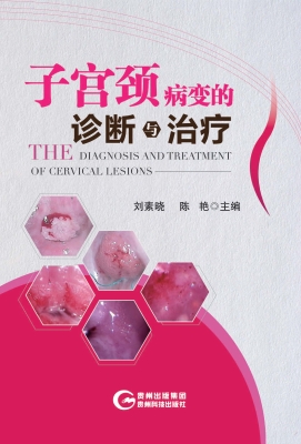 子宫颈病变的诊断与治