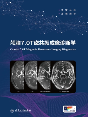 颅脑7.0T磁共振成像诊