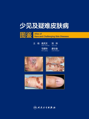少见及疑难皮肤病图鉴