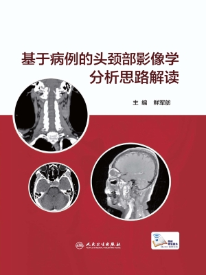 基于病例的头颈部影像