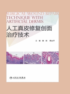 人工真皮修复创面治疗