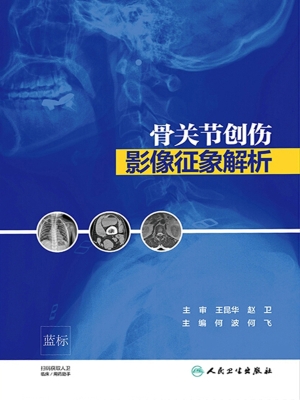 骨关节创伤影像征象解