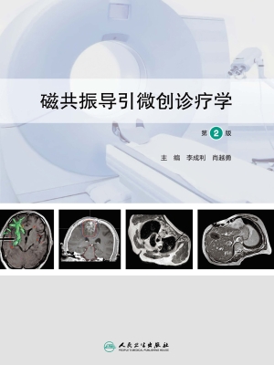 磁共振导引微创诊疗学