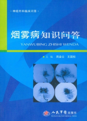烟雾病知识问答