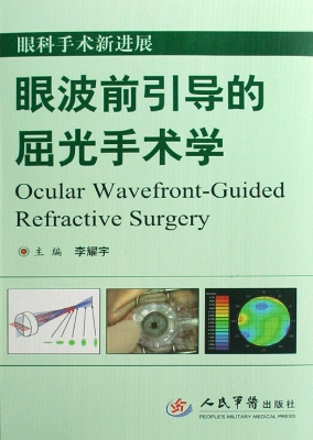 眼波前引导的屈光手术