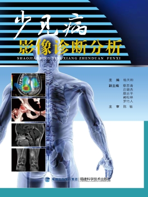 少见病影像诊断分析