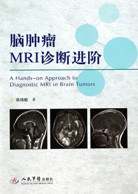 脑肿瘤MRI诊断进阶