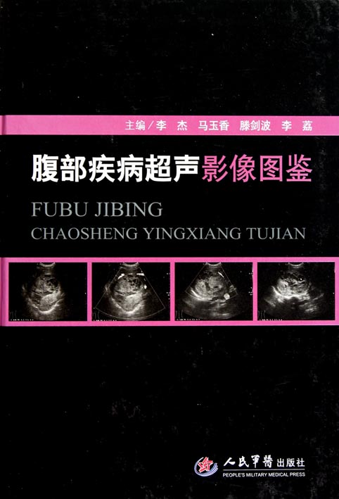 腹部疾病超声影像图鉴