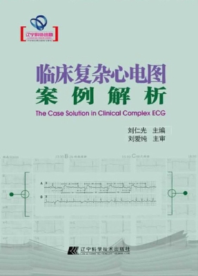 临床复杂心电图案例解
