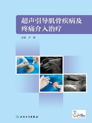 超声引导肌骨疾病及疼