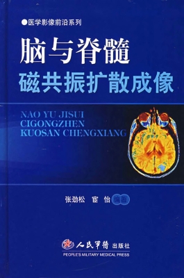脑与脊髓磁共振扩散成