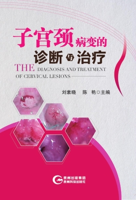 子宫颈病变的诊断与治