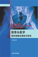 股骨头医学图形图像处