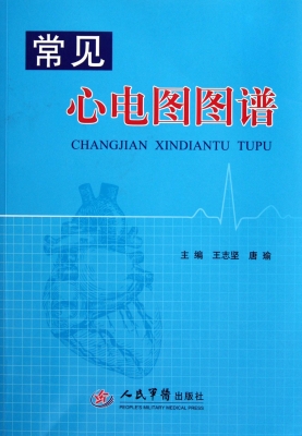 常见心电图图谱